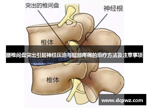腰椎间盘突出引起神经压迫与腿部疼痛的治疗方法及注意事项 腰椎间盘突出引起神经压迫与腿部疼痛的治疗方法及注意事项